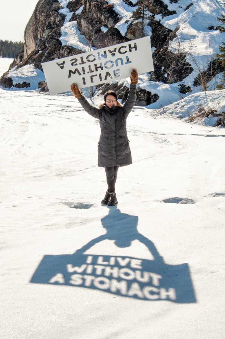 Woman stands in snow holding sign that says "I live without a stomach".