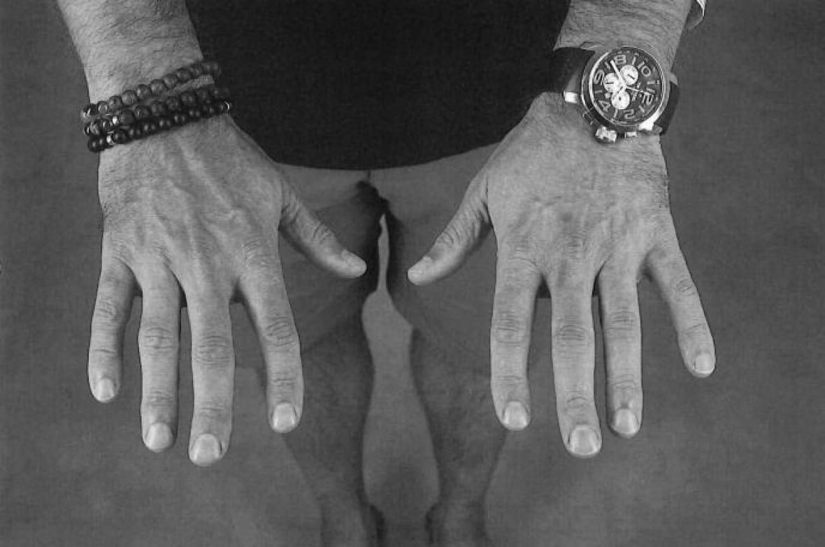Photos of both hands