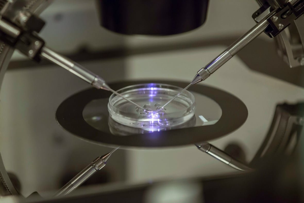 nerdwallet-millennial-money-paying-for-ivf-1 An embryo being created in a petri dish