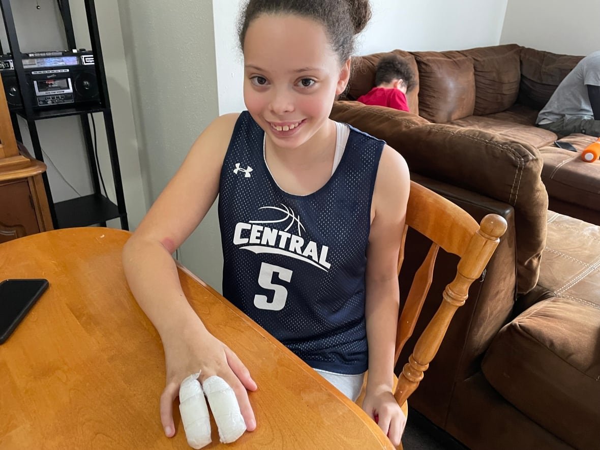 kamara-white-1 A girl wearing a basketball jersey sits at a kitchen table. Two of her fingers are heavily wrapped in bandages.