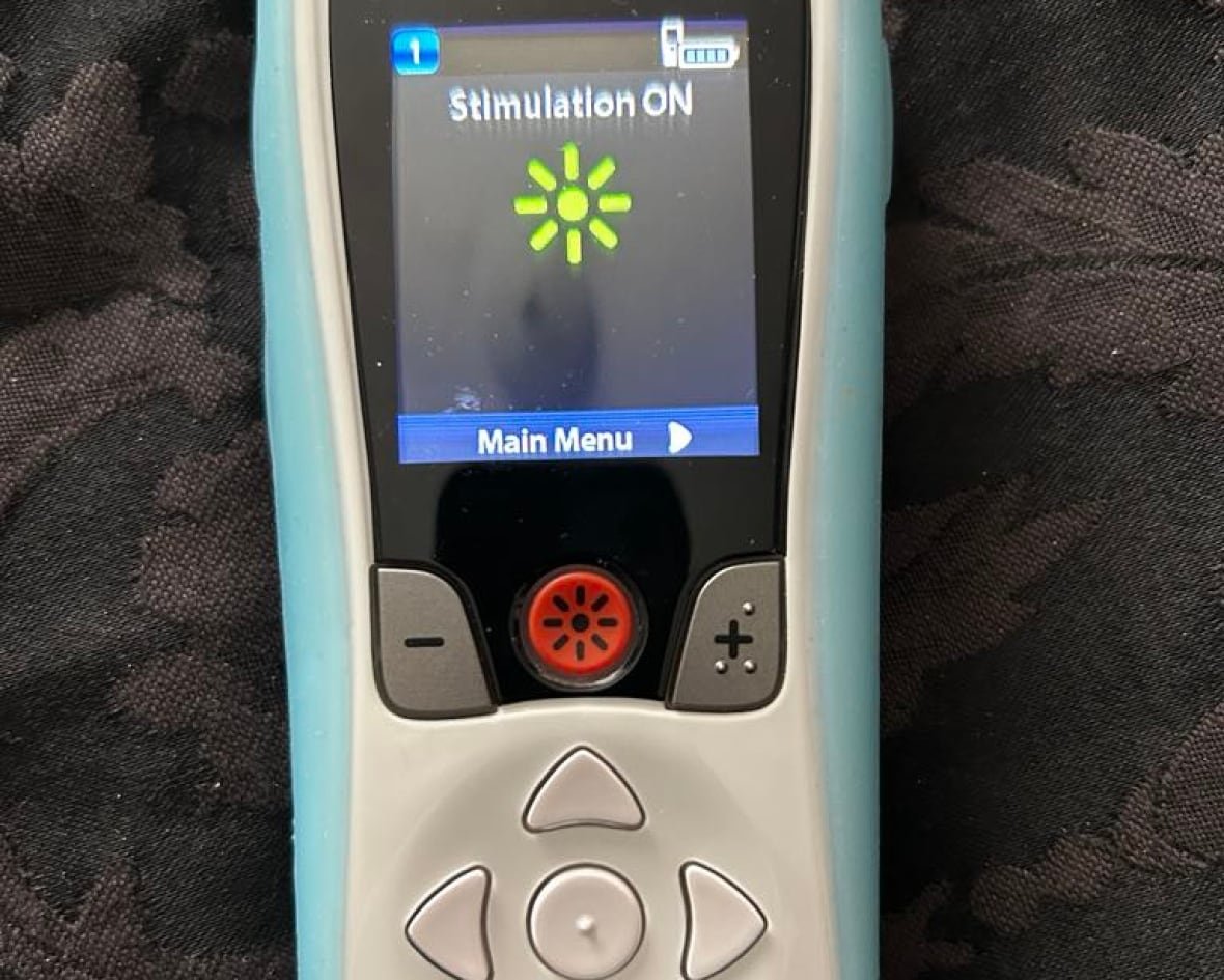 susan-o-sullivan-s-pacemaker A small white remote that says "Sttimulation ON."