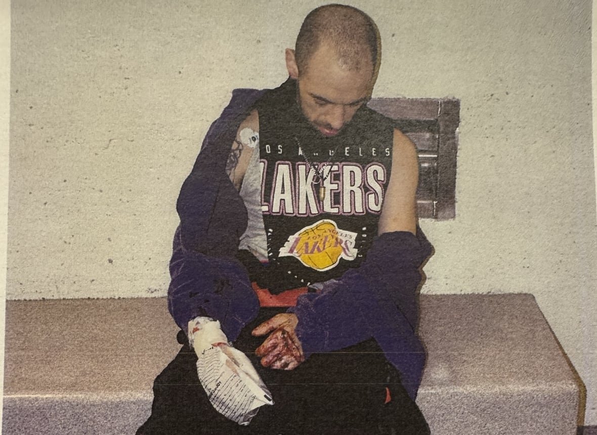 zakkary-reed-3 Man sits with his head down, one hand bloody and the other wrapped in a plastic bag.