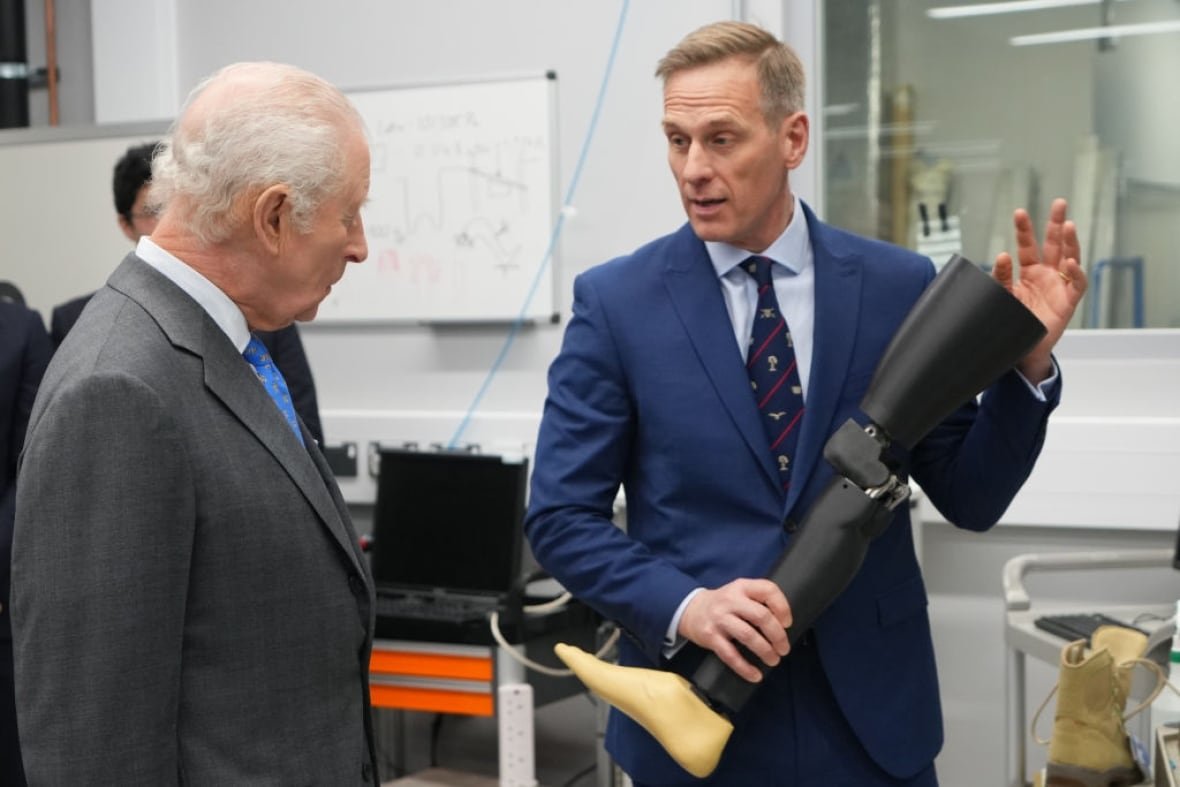 2199852153 A person speaks to another person holding a prosthetic leg.