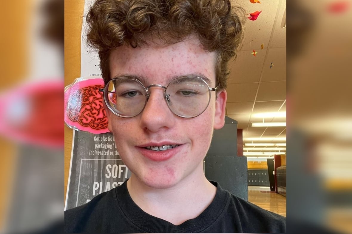 chase-de-balinhard-1 A teen boy with short, curly hair, glasses and braces looks into the camera.
