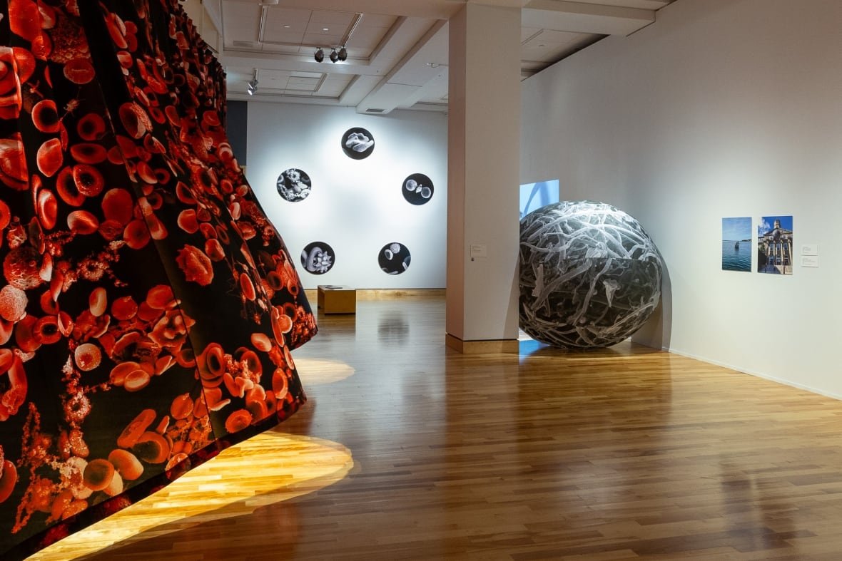 kim-morgan-s-artwork Artwork created out of magnified images of blood cells are seen in an art gallery.