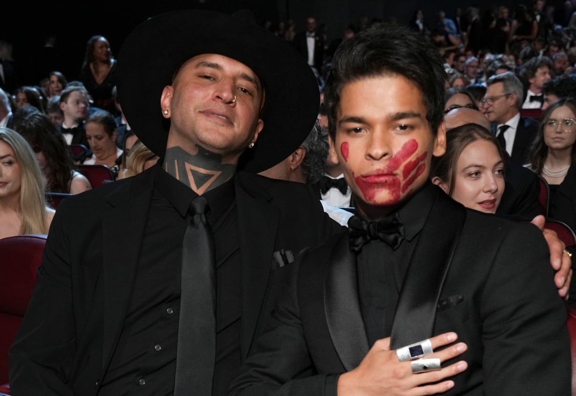 76th-emmy-awards-audience A man with a red hand print on his mouth poses in an auditorium.