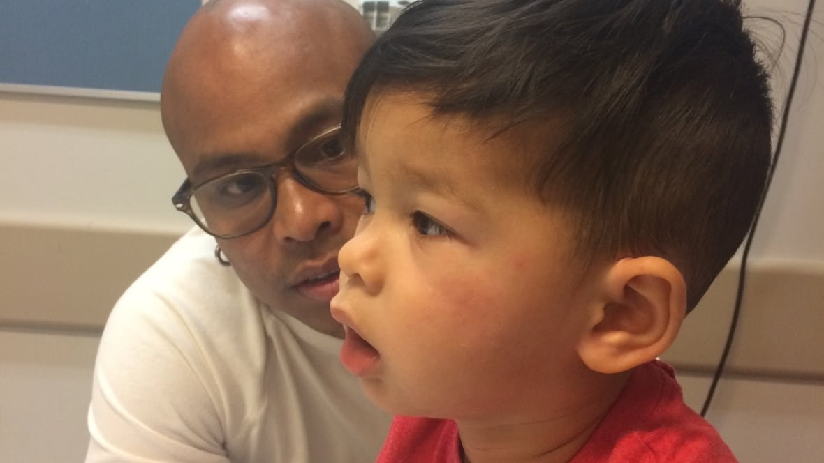 simon-after-allergy-attack A concerned man watches a boy with hives on his cheeks and his mouth open in a hospital room.